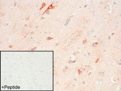 FPR2 Polyclonal Antibody:Antibodies, Polyclonal