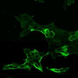 Invitrogen&trade;&nbsp;Calcitonin Receptor Polyclonal Antibody