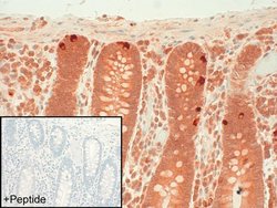 Invitrogen Calcitonin Receptor Polyclonal Antibody 100 &mu;g | Buy Online | Invitrogen&trade; | Fisher Scientific