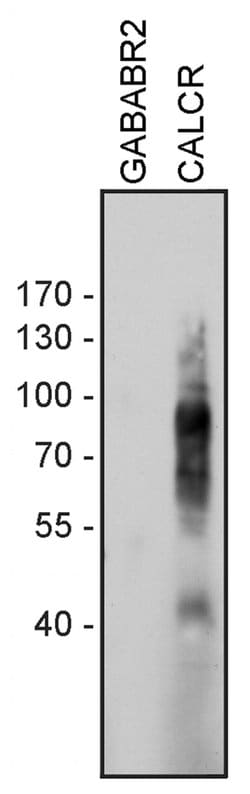 Invitrogen Calcitonin Receptor Polyclonal Antibody 100 &mu;g | Buy Online | Invitrogen&trade; | Fisher Scientific