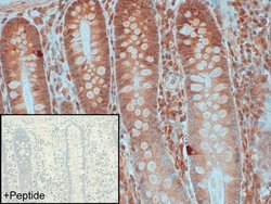 Invitrogen GPR56 Polyclonal Antibody 100 &mu;g; Unconjugated:Antibodies,
