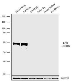 Invitrogen LGI1 Polyclonal Antibody 100 &mu;g; Unconjugated:Antibodies,