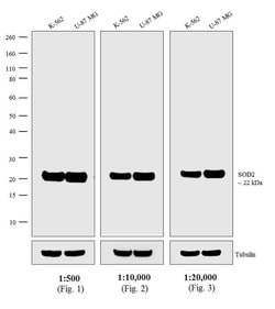 Invitrogen Donkey anti-Mouse IgG (H+L) Secondary Antibody, Biotin 2 mg;