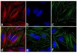 Invitrogen Goat anti-Mouse IgG (H+L) Highly Cross-Adsorbed Secondary Antibody, TRITC 1 mg | Buy Online | Invitrogen&trade; | Fisher Scientific