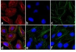 Invitrogen Goat anti-Rabbit IgG (H+L) Secondary Antibody, TRITC 1 mg; TRITC:Antibodies,