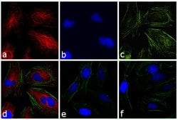 Invitrogen Goat anti-Rabbit IgG (H+L) Highly Cross-Adsorbed Secondary Antibody,