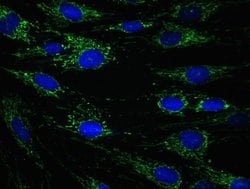 Invitrogen&trade;&nbsp;ECH1 Monoclonal Antibody (9D11AF3)