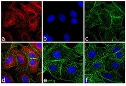 Invitrogen&trade;&nbsp;F(ab')2-Goat anti-Rat IgG (H+L) Cross-Adsorbed Secondary Antibody, TRITC