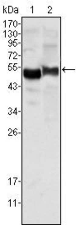 Invitrogen alpha-1 Antitrypsin Monoclonal Antibody (2B12) 100 &mu;L; Unconjugated:Antibodies,