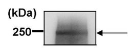 Invitrogen ABCA1 Polyclonal Antibody 100 μL; Unconjugated:Antibodies,