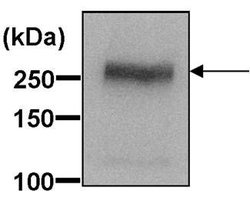 Invitrogen ABCA1 Polyclonal Antibody 100 μL; Unconjugated:Antibodies,