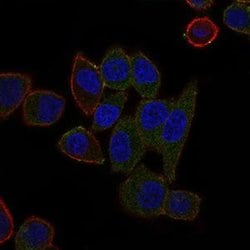 ABCB5 Monoclonal Antibody (5H3C6), Invitrogen 100 &mu;g; Unconjugated:Antibodies,