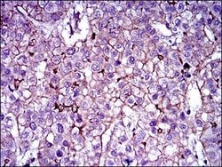 ABCB5 Monoclonal Antibody (5H3C6), Invitrogen 100 &mu;g; Unconjugated:Antibodies,