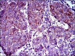 ABCB5 Monoclonal Antibody (5H3C6), Invitrogen 100 &mu;g; Unconjugated:Antibodies,