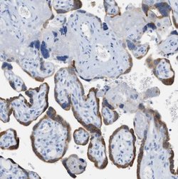 Invitrogen PAPPA Monoclonal Antibody (PAPP A 1-1) 400 &mu;L; Unconjugated:Antibodies,