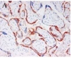 Invitrogen PAPPA Monoclonal Antibody (PAPP A 1-1) 400 &mu;L; Unconjugated:Antibodies,