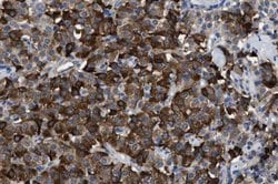 Invitrogen Leptin Monoclonal Antibody (3) 400 &mu;L; Unconjugated:Antibodies,