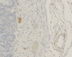 Invitrogen CGRP Monoclonal Antibody (4) 400 &mu;L; Unconjugated:Antibodies,