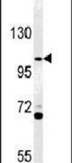 ACAP3 Rabbit anti-Human, Polyclonal, Invitrogen 400 &mu;L; Unconjugated:Antibodies,