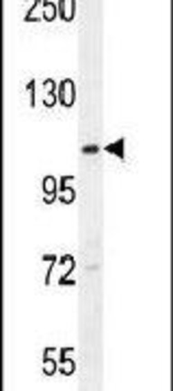 MCAD Rabbit anti-Human, Polyclonal, Invitrogen 400 &mu;L; Unconjugated:Antibodies,