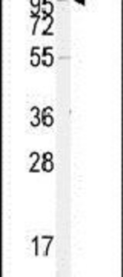 ACE2 Rabbit anti-Human, Polyclonal, Invitrogen 400 &mu;L; Unconjugated:Antibodies,