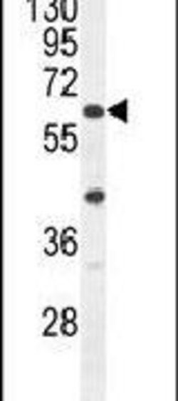 ACF Rabbit anti-Human, Polyclonal, Invitrogen 400 &mu;L; Unconjugated:Antibodies,