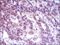 Invitrogen ATP Citrate Lyase Monoclonal Antibody (5F8D11) 100 &mu;g; Unconjugated:Antibodies,