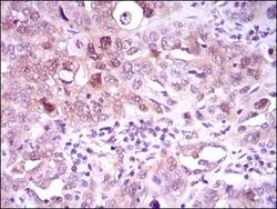 Invitrogen ATP Citrate Lyase Monoclonal Antibody (5F8D11) 100 &mu;g; Unconjugated:Antibodies,