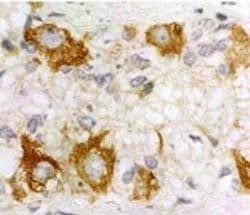 Invitrogen PACAP Receptor Polyclonal Antibody 100 &mu;L; Unconjugated:Antibodies,