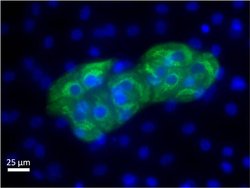 AFP Monoclonal Antibody (F1-6P2A8-P2B9A9), Invitrogen 1 mg; Unconjugated:Antibodies,