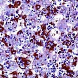 Invitrogen AFP Polyclonal Antibody 1 mL; Unconjugated:Antibodies, Polyclonal