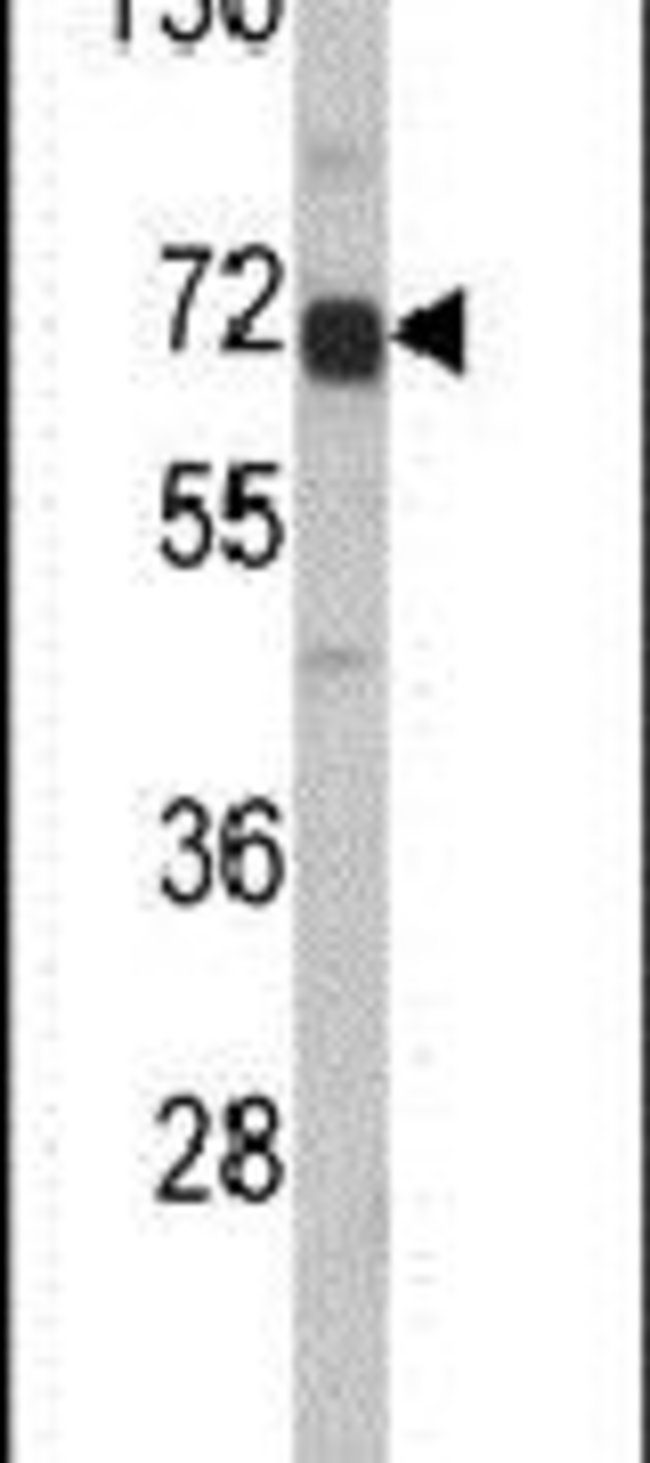 AFP Polyclonal Antibody, Invitrogen™ 400 μL; Unconjugated | Fisher ...