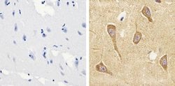 Invitrogen Tau (Cleaved Asp421, Asp422) Monoclonal Antibody (TauC3) 50 &mu;g | Buy Online | Invitrogen&trade; | Fisher Scientific