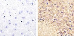 Invitrogen Tau (Cleaved Asp421, Asp422) Monoclonal Antibody (TauC3) 50 &mu;g | Buy Online | Invitrogen&trade; | Fisher Scientific