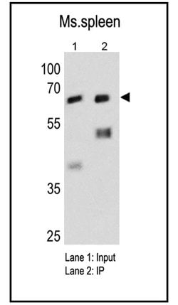 Fyn Monoclonal Antibody (1S), Invitrogen 100 &mu;L; Unconjugated:Antibodies,