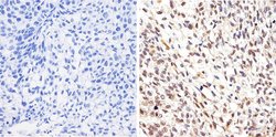 Invitrogen AKT1 Monoclonal Antibody (9Q7) 100 &mu;g; Unconjugated:Antibodies,