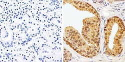Invitrogen AKT1 Monoclonal Antibody (9Q7) 100 &mu;g; Unconjugated:Antibodies,