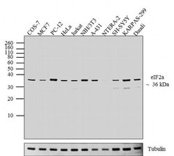 EIF2S1 Polyclonal Antibody, Invitrogen 100 &mu;g; Unconjugated:Antibodies,