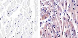 Invitrogen p38 MAPK Polyclonal Antibody 100 &mu;g; Unconjugated:Antibodies,