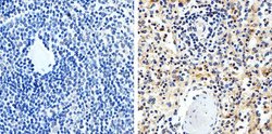 Invitrogen FAK Monoclonal Antibody (34Q36) 100 &mu;g; Unconjugated:Antibodies,