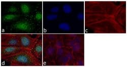 Invitrogen FAK Monoclonal Antibody (34Q36) 100 &mu;g; Unconjugated:Antibodies,
