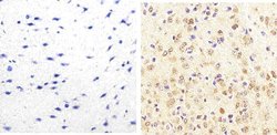 Invitrogen JNK1/JNK2 Monoclonal Antibody (279Q38) 100 &mu;g; Unconjugated:Antibodies,