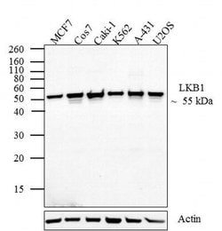Invitrogen LKB1 Monoclonal Antibody (206R24) 100 &mu;g; Unconjugated:Antibodies,