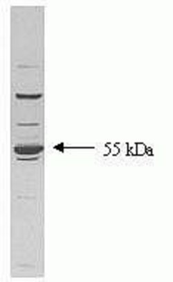 Invitrogen TGFBR1 Monoclonal Antibody (234R32) 100 &mu;g; Unconjugated:Antibodies,
