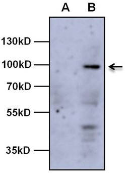 Invitrogen AHR Monoclonal Antibody (RPT9) 100 &mu;L; Unconjugated:Antikroppar