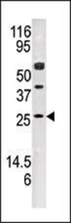Adenylate Kinase 3 Rabbit anti-Human, Mouse, Polyclonal, Invitrogen 400