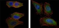 Invitrogen AKT2 Monoclonal Antibody (1B6) 100 &mu;L; Unconjugated:Antibodies,