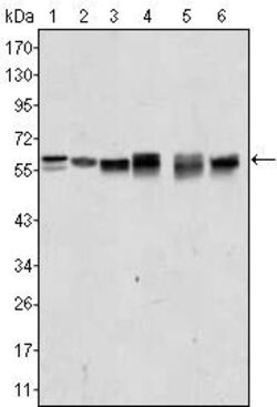 Invitrogen AKT2 Monoclonal Antibody (1B6) 100 &mu;L; Unconjugated:Antibodies,