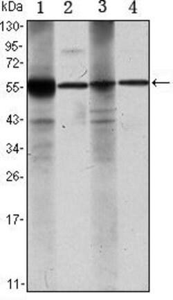 Invitrogen ALDH1A1 Monoclonal Antibody (5A11) 100 &mu;L; Unconjugated:Antibodies,