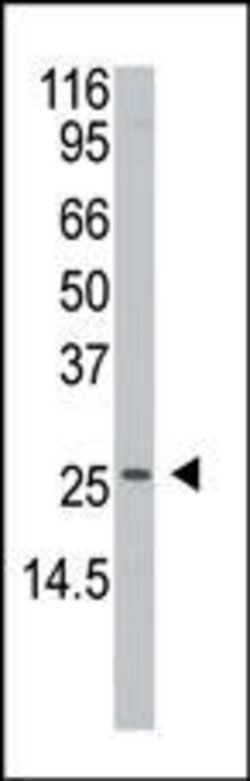 APH1 Rabbit anti-Human, Polyclonal, Invitrogen 400 &mu;L; Unconjugated:Antibodies,